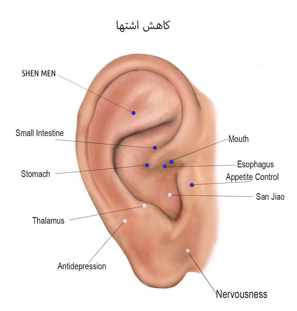 اشتهای زیاد